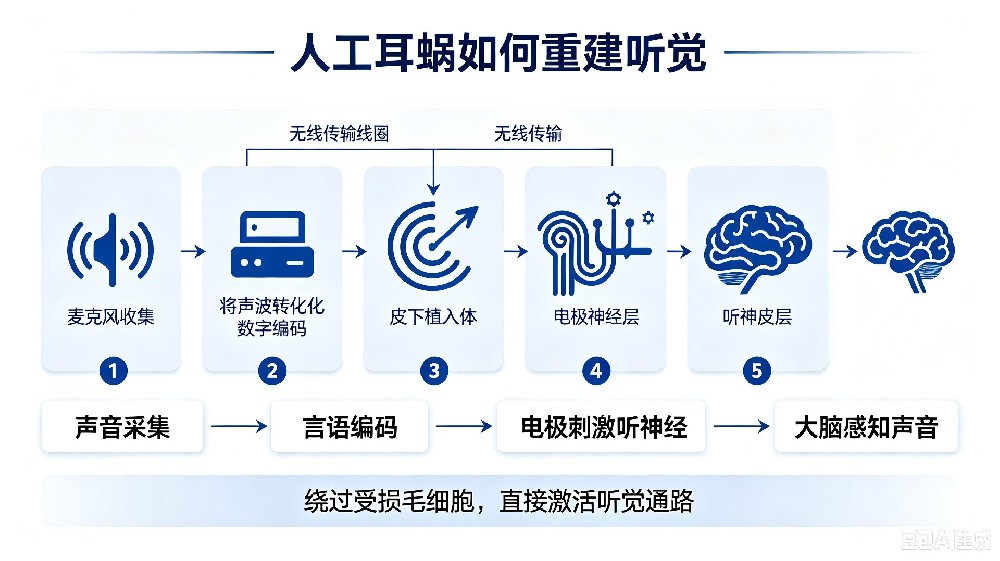 人工耳蜗科普 (1).jpg